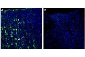 Expression of MAGT1 in rat cortex. (MAGT1 anticorps  (Extracellular, N-Term))