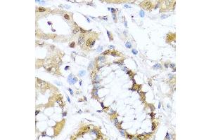 Immunohistochemistry of paraffin-embedded human stomach using TET2 antibody at dilution of 1:100 (40x lens).