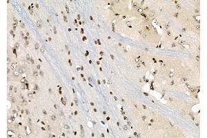 ABIN6258846 and ABIN6274264 at 1/100 staining Rat brain tissue by IHC-P. (HOXA1 anticorps  (Internal Region))