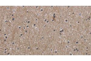 Immunohistochemistry of paraffin-embedded Human brain using PPAT Polyclonal Antibody at dilution of 1:50 (PPAT anticorps)