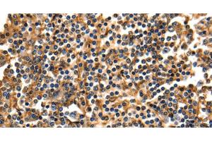 Immunohistochemistry of paraffin-embedded Human tonsil using ANXA5 Polyclonal Antibody at dilution of 1:40 (Annexin V anticorps)