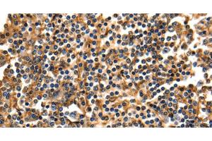 Immunohistochemistry of paraffin-embedded Human tonsil using ANXA5 Polyclonal Antibody at dilution of 1:40