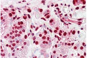 Anti-HnRNP K antibody IHC staining of human adrenal. (HNRNPK anticorps  (AA 1-50))