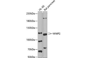 Western blot analysis of extracts of various cell lines, using WWP2 antibody (ABIN6128368, ABIN6150276, ABIN6150277 and ABIN6222535) at 1:1000 dilution. (WWP2 anticorps  (AA 1-270))