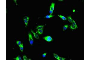 Immunofluorescent analysis of Hela cells using ABIN7155305 at dilution of 1:100 and Alexa Fluor 488-congugated AffiniPure Goat Anti-Rabbit IgG(H+L)