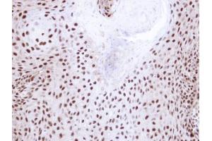 IHC-P Image Immunohistochemical analysis of paraffin-embedded Cal27 xenograft, using NHP2-like protein 1, antibody at 1:100 dilution. (NHP2L1 anticorps  (full length))