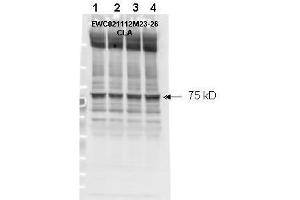 Affinity purified phospho-specific antibody to NF2 (Merlin) at pS518 was used at a 1:1000 dilution to detect NF2 by Western blot. (Merlin anticorps  (pSer518))