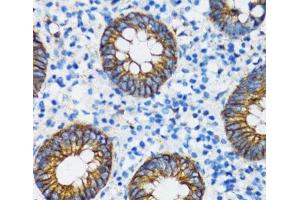 Immunohistochemistry of paraffin-embedded Human vermiform appendix using CTNNA1 Polyclonal Antibody at dilution of 1:100 (40x lens).