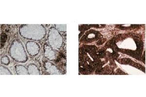 Immunohistochemistry (IHC) image for anti-Chaperonin Containing TCP1, Subunit 2 (Beta) (CCT2) (C-Term) antibody (ABIN264513)