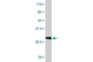 Western Blot detection against Immunogen (36. (Recoverin anticorps  (AA 101-199))