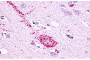 Anti-GPR61 antibody  ABIN1048846 IHC staining of human brain, neurons and glia. (GPR61 anticorps  (N-Term))