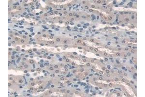 Detection of HPS4 in Mouse Kidney Tissue using Polyclonal Antibody to Hermansky Pudlak Syndrome Protein 4 (HPS4)