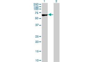 Western Blot analysis of MYBPH expression in transfected 293T cell line by MYBPH MaxPab polyclonal antibody. (MYBPH anticorps  (AA 1-477))