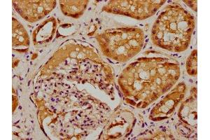 IHC image of ABIN7169172 diluted at 1:100 and staining in paraffin-embedded human kidney tissue performed on a Leica BondTM system. (Sbk2 anticorps  (AA 62-330))