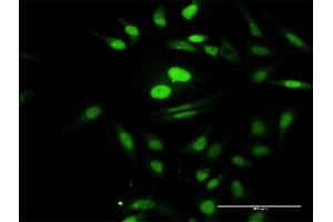 Immunofluorescence of purified MaxPab antibody to PTMS on HeLa cell. (Parathymosin anticorps  (AA 1-102))