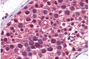 Human Testis: Formalin-Fixed, Paraffin-Embedded (FFPE)