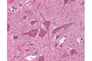 Anti-NUMB antibody IHC of human brain, cortex. (NUMB anticorps  (AA 1-214))
