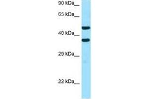 Image no. 1 for anti-Sideroflexin 2 (SFXN2) (AA 186-235) antibody (ABIN6747369) (SFXN2 anticorps  (AA 186-235))