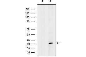 Western blot analysis of lysates from 3, using Hsp Antibody. (HspB4 (Internal Region) anticorps)