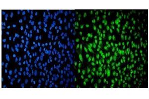 IF analysis of USP16 using anti-USP16 antibody (ABIN7602640). (USP16 anticorps  (AA 9-823))