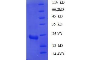 SDS-PAGE (SDS) image for Ribosomal Protein S7 (RPS7) (AA 2-179) protein (His tag) (ABIN5712588)