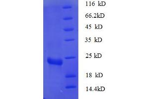 SDS-PAGE (SDS) image for Ribosomal Protein S7 (RPS7) (AA 2-179) protein (His tag) (ABIN5712588) (RPS7 Protein (AA 2-179) (His tag))