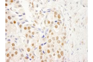 Immunohistochemistry (IHC) image for anti-Nuclear Receptor Binding Factor 2 (NRBF2) (AA 125-175) antibody (ABIN7448699) (NRBF2 anticorps  (AA 125-175))