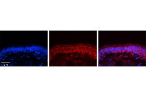 Rabbit Anti-C14orf166 Antibody     Formalin Fixed Paraffin Embedded Tissue: Human Bronchial Epithelial Tissue  Observed Staining: Cytoplasmic  Primary Antibody Concentration: 1:100  Secondary Antibody: Donkey anti-Rabbit-Cy3  Secondary Antibody Concentration: 1:200  Magnification: 20X  Exposure Time: 0. (C14orf166 anticorps  (N-Term))