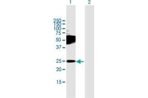 Western Blot analysis of TMEM123 expression in transfected 293T cell line by TMEM123 MaxPab polyclonal antibody. (TMEM123 anticorps  (AA 1-208))