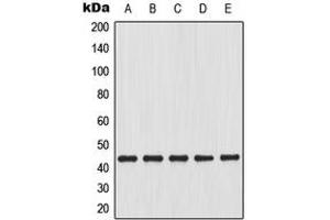 Western blot analysis of Connexin 43 expression in C6 (A), HeLa (B), C2C12 (C), mouse heart (D), rat brain (E) whole cell lysates. (Connexin 43/GJA1 anticorps  (C-Term))