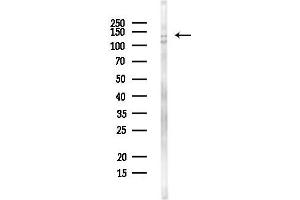 anti-Cullin-Associated and Neddylation-Dissociated 1 (CAND1) antibody