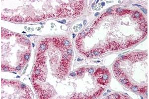 Human Kidney (formalin-fixed, paraffin-embedded) stained with MMP2 antibody ABIN337360 at 10 ug/ml followed by biotinylated anti-mouse IgG secondary antibody ABIN481714, alkaline phosphatase-streptavidin and chromogen.