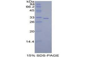 SDS-PAGE analysis of Mouse MAP2K7 Protein. (MAP2K7 Protéine)