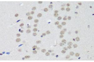 Immunohistochemistry of paraffin-embedded Mouse brain using CTCF Polyclonal Antibody at dilution of 1:200 (40x lens).