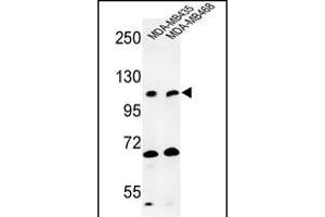 Western blot analysis of EXTL3 Antibody (N-term) (ABIN652990 and ABIN2842629) in MDA-M, MDA-M cell line lysates (35 μg/lane).