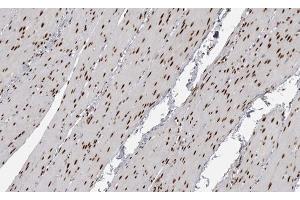 ABIN6267591 at 1/200 staining human Smooth muscle tissue sections by IHC-P. (MEF2A anticorps  (pThr319))