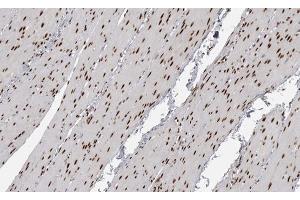 ABIN6267591 at 1/200 staining human Smooth muscle tissue sections by IHC-P.