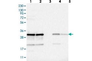 Western blot analysis of Lane 1: RT-4, Lane 2: U-251 MG, Lane 3: Human Plasma, Lane 4: Liver, Lane 5: Tonsil with CCDC43 polyclonal antibody  at 1:250-1:500 dilution. (CCDC43 anticorps)
