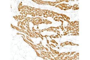 anti-Cardiac Troponin I (TNNI3) antibody