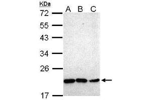 WB Image Sample (30 ug of whole cell lysate) A: Hep G2 , B: Molt-4 , C: Raji 12% SDS PAGE antibody diluted at 1:1000 (NKX2-8 anticorps)