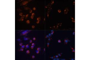 Immunofluorescence analysis of NIH/3T3 cells using MAP1LC3B antibody (ABIN6291775) at dilution of 1:100. (LC3B anticorps)