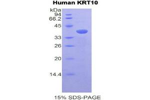 SDS-PAGE (SDS) image for Keratin 10 (KRT10) (AA 153-456) protein (His tag) (ABIN1877868)