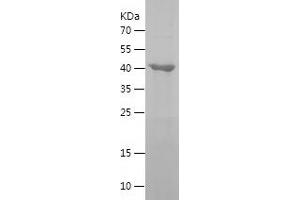 Western Blotting (WB) image for GTP Binding Protein 3 (Mitochondrial) (GTPBP3) (AA 282-492) protein (His-IF2DI Tag) (ABIN7123224)