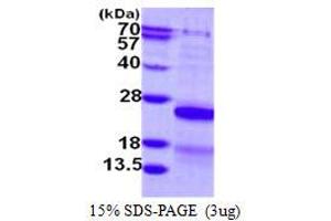 Image no. 1 for Cysteine and Glycine-Rich Protein 2 (CSRP2) (AA 1-193) protein (His tag) (ABIN1098276)
