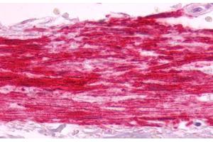 Image no. 2 for anti-Bradykinin Receptor B1 (BDKRB1) (Cytoplasmic Domain) antibody (ABIN1048348)