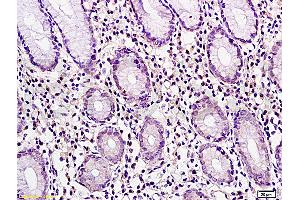 Immunohistochemistry (IHC) image for anti-Cancer/testis Antigen 2 (CTAG2) (AA 121-210) antibody (ABIN721135) (CTAG2 anticorps  (AA 121-210))