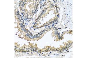 Immunohistochemistry of paraffin-embedded human prostate using CST1 antibody (ABIN5975714) at dilution of 1/100 (40x lens). (CST1 anticorps)