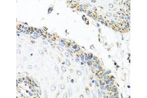Immunohistochemistry of paraffin-embedded Human esophagus using GNRH2 Polyclonal Antibody at dilution of 1:100 (40x lens).