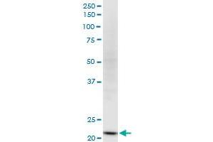 NDUFV2 monoclonal antibody (M03), clone 1A10.