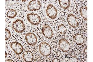 Immunoperoxidase of purified MaxPab antibody to CARF on formalin-fixed paraffin-embedded human colon. (CDKN2AIP anticorps  (AA 1-579))